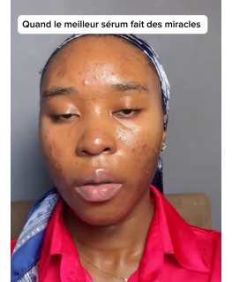 Anua Heartleaf 80% Rauhoittava Ampulli